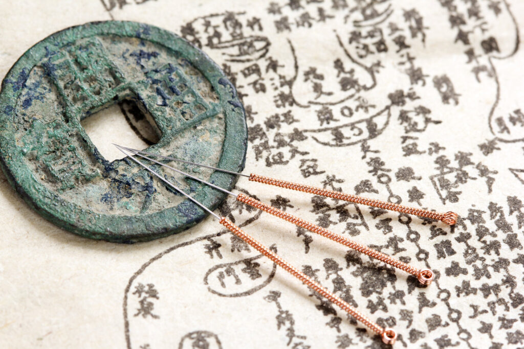 Akupunkturnadeln und altes, chinesisches Medizinbuch
